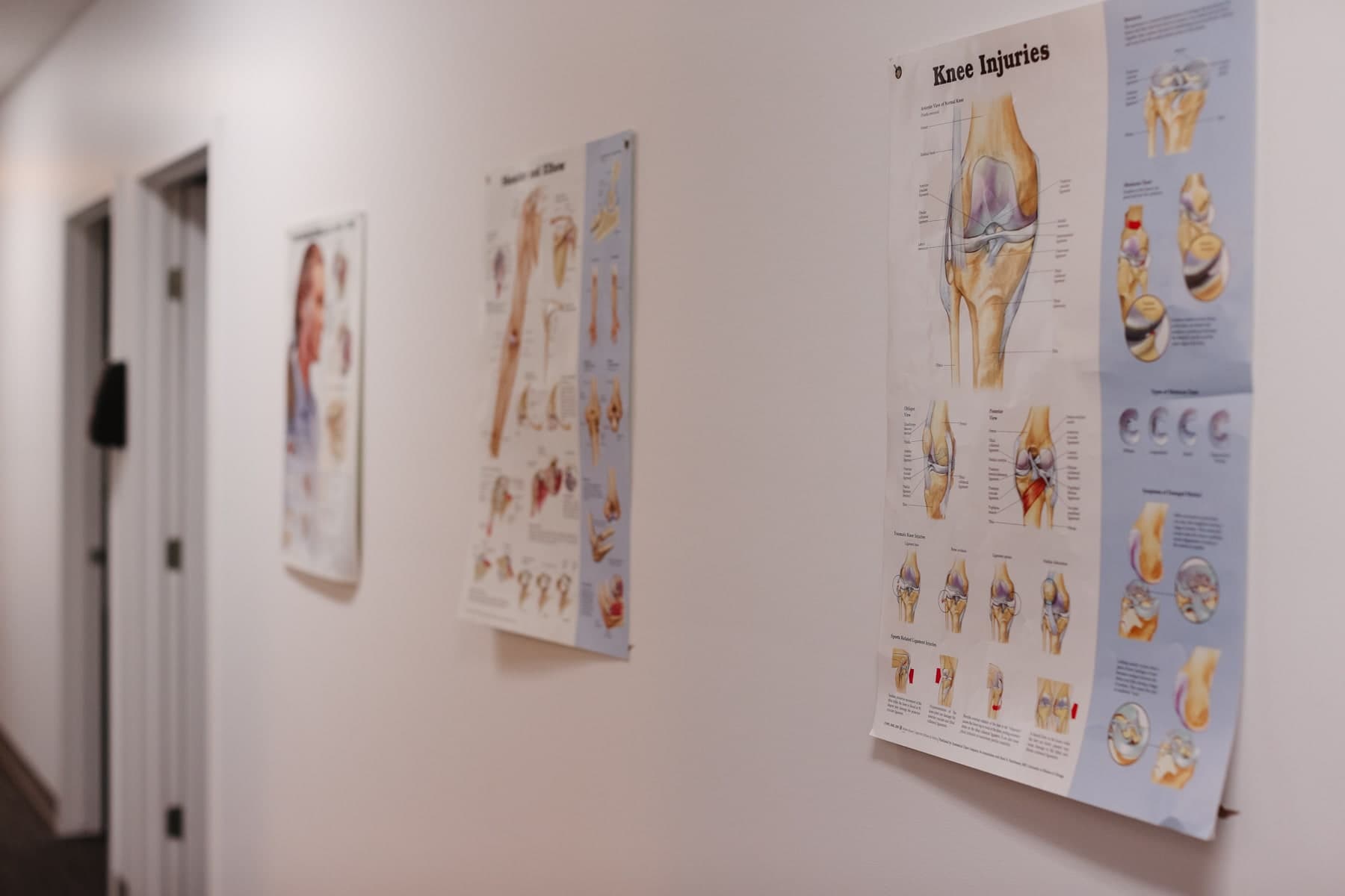 Hallway wall with anatomical posters including a Knee Injuries chart showing normal knee anatomy, ligament injuries, and cartilage damage, and a Shoulder and Elbow chart, Swift Current clinic corridor